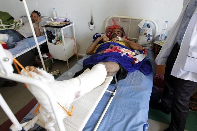 A Yemeni man recovers in hospital in the capital Sanaa on April 21, 2015, after he was wounded in Saudi-led air strikes the previous day